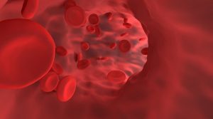 blood cells causing varicose veins