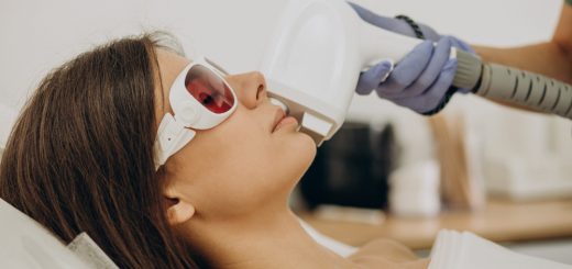 a women having laser skin treatment